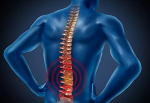 MusculoskeletalDisorder