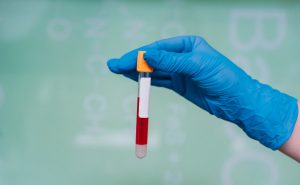 health-rubber-gloved-hand-holds-one-test-tube-with-drug_1153-3908